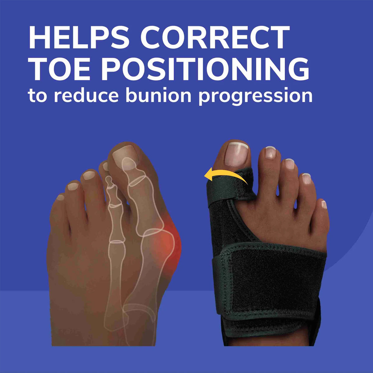แผ่นเจลแบบปรับได้ สำหรับผู้ที่มีภาวะนิ้วหัวแม่เท้าเอียง Dr.Scholls Bunion Relief and Toe Corrector Massaging Gel Splint - Scholl Shoes Thailand